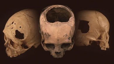 Photo of The Incas Mastered the Grisly Practice of Drilling Holes in Peopleâ€™s Skulls